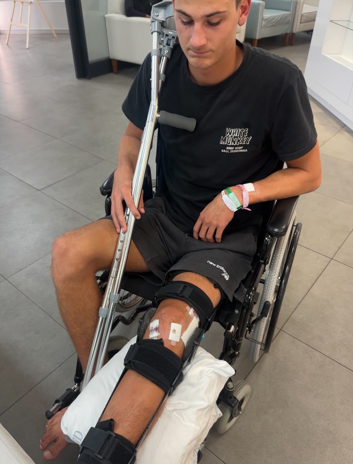 Nate Colby after his second ACL injury